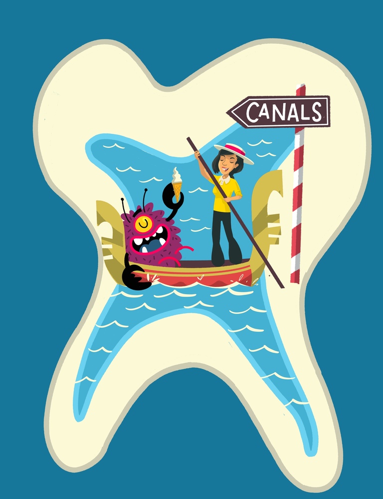 Root Canal